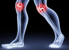 Nga take mo te whanaketanga o nga arthorosis turi