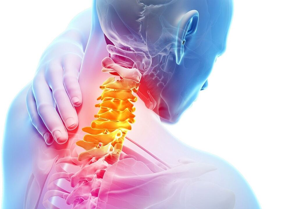 osteochondrosis o te tuara cervical